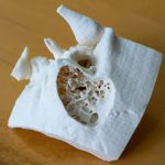 Intraoperativer 3D-Druck eines Mastoidknochens, hergestellt mit einem Prusa I3 MK3S Drucker