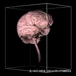 Erste 3D-Rekonstruktion eines Gehirns aus MRT