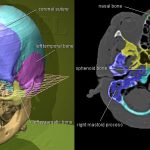 CT-Bilder des Kopfes