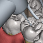VOXEL-MAN Dental