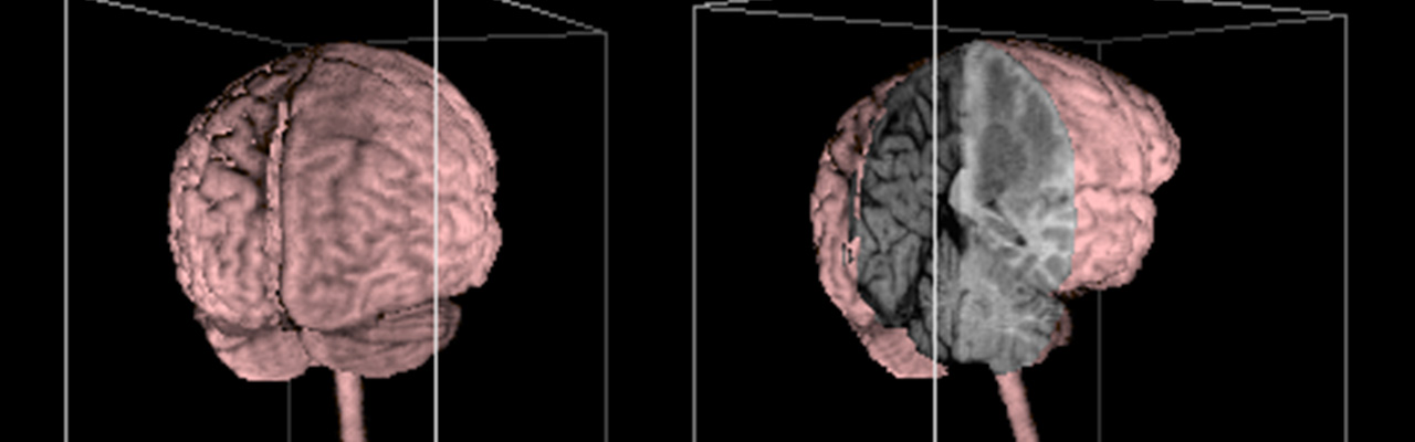 Erste 3D-Rekonstruktion des Gehirns