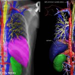 Röntgenbild mit eingefärbten Organen
