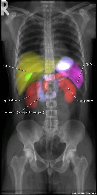Röntgenbild mit mehreren inneren Organen