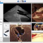 Benutzeroberfläche mit Ultraschall und anatomischem Schnittbild, endoskopischer Ansicht und orthogonalen Navigationsbildern