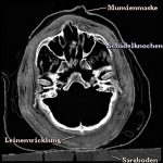 Transversales Schnittbild der Mumie aus CT