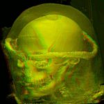 Mumie mit transparenter Hülle in Rot-Grün-Stereo