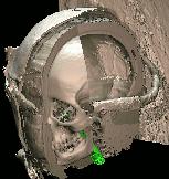Stock der Virtuellen Mumie