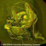 Virtuelle Präparation des Gehirns des Visible Human in Rot/Grün-Stereo