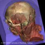 Schädel und Kopfmuskulatur des Visible Human