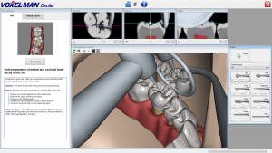 Patient, Bohrer und Dentalspiegel von VOXEL-MAN Dental