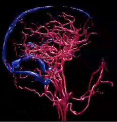 3d imaging of the brain: Vessels of the brain