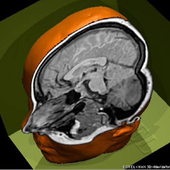 3d imaging of the brain: Arbitrary cutting