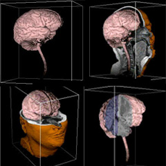 first 3D image of excised brain from MRI