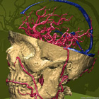 3d imaging of the brain: Vessels of the brain